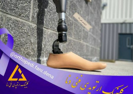 ساخت پای مصنوعی در کلینیک ارتوپدی فنی دنا شیراز