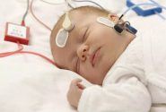 علل و آثار مشکل شنوایی در نوزادان