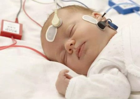 علل و آثار مشکل شنوایی در نوزادان