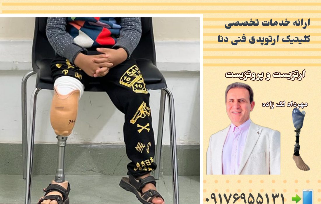 ساخت بهترین اندام مصنوعی در شیراز