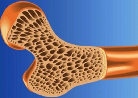 آغاز پویش «پیشگیری از پوکی استخوان» در فارس
