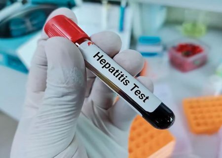 برنامه‌های غربالگری بیماری هپاتیت C در فارس گسترش می‌یابد