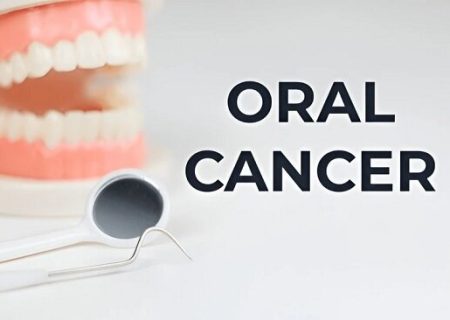 سرطان دهان چیست؟